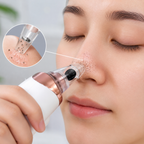 5 in 1 electric blackhead remover